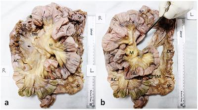 Development of a Novel Technique to Dissect the Mesentery That Preserves Mesenteric Continuity and Enables Characterization of the ex vivo Mesentery